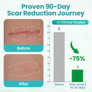 EliteAloe Spray | Removedor de Cicatrizes