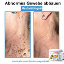 Venom Essense (Remove verrugas, clareia manchas e alivia a psoríase enquanto transforma sua pele de forma rápida e segura)